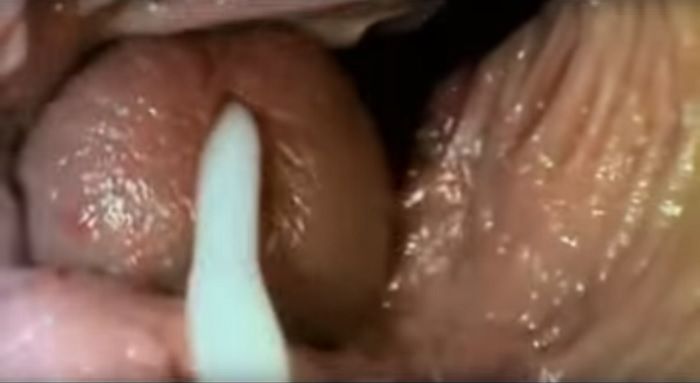 mri ejaculation inside vagina